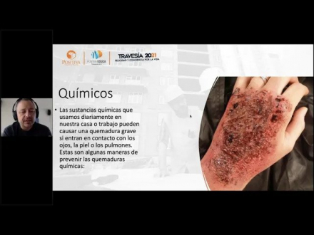 Brigadistas- Respuesta inicial a emergencias por quemaduras