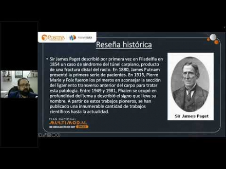 Síndrome de túnel del carpo, diagnóstico, clasificación y tratamiento