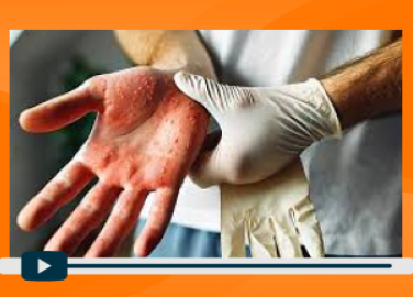 SESIÓN 2 - ALERGIA AL LÁTEX - EL ENEMIGO SILENCIOSO DEL PERSONAL DE SALUD - SECTOR SALUD - PORTADA