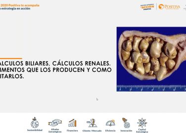 Cálculos biliares y renales, alimentos que los producen y cómo evitarlos