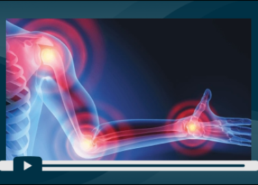 sesion-3-intervenciones-de-impacto-y-perspectivas-futuras-para-la-promocion-de-la-salud-musculoesqueletica-portada